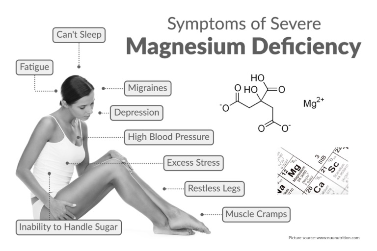 Magnesium Deficiency. Some Facts about Magnesium